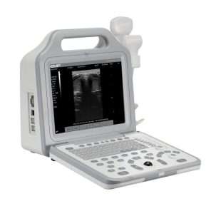 Portable Ultrasound Machine-EMP N2Power Portable Ultrasound Machine-EMP N2Power